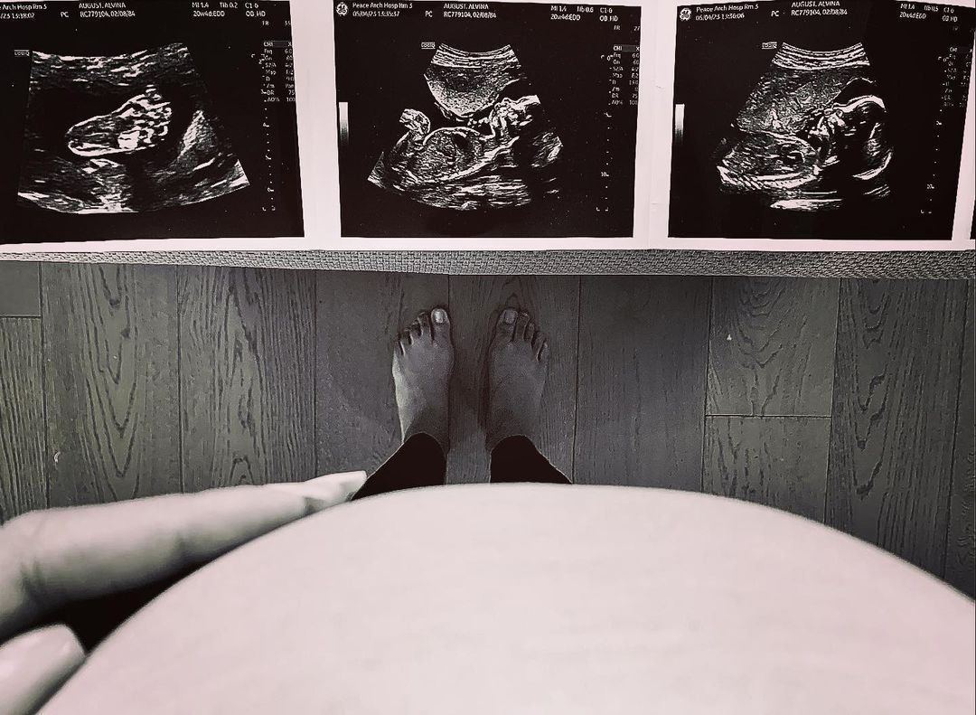 Marco Grazzini and Alvina August are expecting a baby