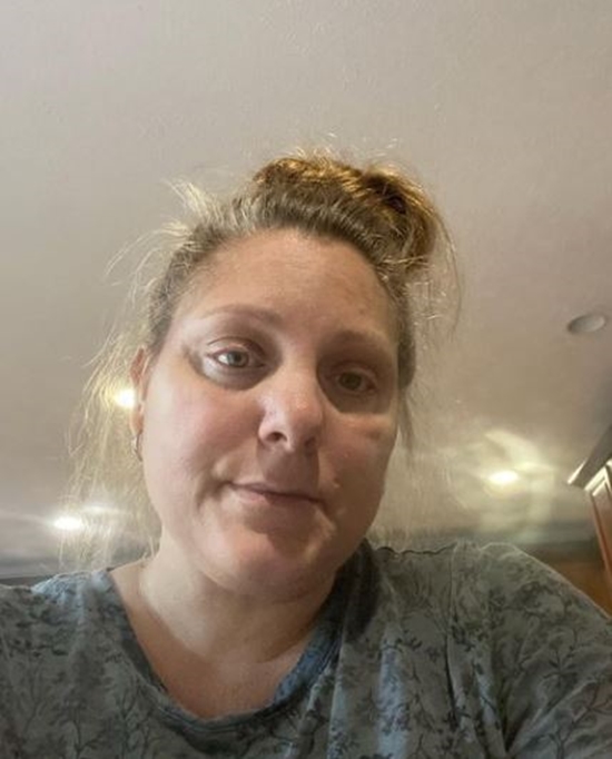 Was 90 Day Fiance Star Anna Campisi Ill From Surgery Complications