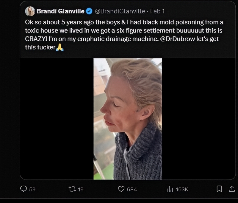 Brandi Glanville Posts Alarming Health Status On X