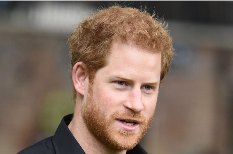Visible Scar On Prince Harry’s Left Ear Evidence of Hair Transplant?