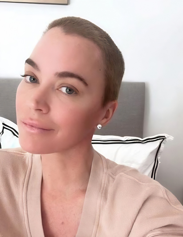 One side of Teddi's head is bald - @teddimellencamp - Instagram