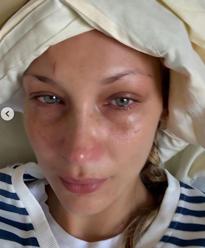 Bella looked unwell and as if she'd been crying - Instagram