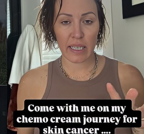 Braunwyn on day one of chemo cream – Instagram