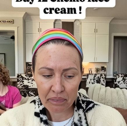 Hitting the ugly stage – @braunwynwindhamburke – Instagram