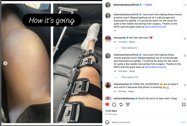 The Young and the Restless Star Eileen Davidson Hospitalized After Scary Accident